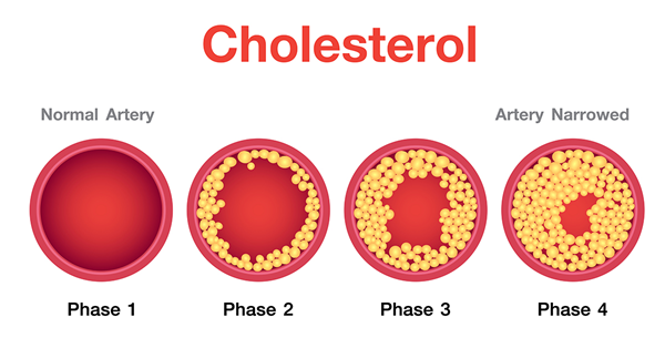 Cholesterol