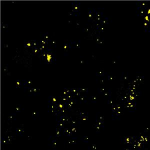 AIE Yellow Probe for Lipid droplets