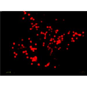 AIE Super-Resolution RED - Lipid Droplets