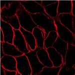 AIE Red Probe for Plasma Membrane