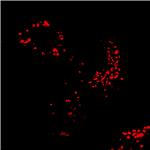 AIE Red Probe for Lysosome