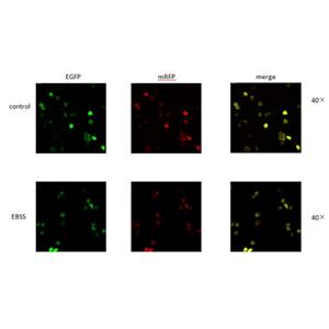 mRFP-EGFP-LC3穩(wěn)轉細胞株