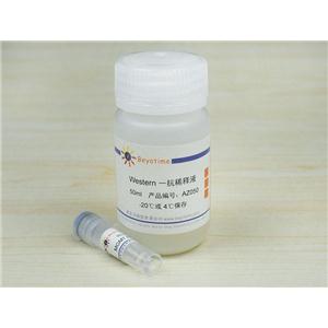 MGMT Rabbit Polyclonal Antibody