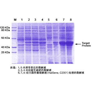 大腸桿菌蛋白提取