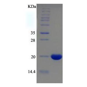 人低分子量磷酸酪氨酸蛋白磷酸酶