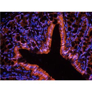 ATF4 antibody