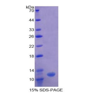2',5'-寡腺苷酸合成酶1(OAS1)重組蛋白