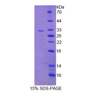 C-Ros癌基因1(ROS1)重組蛋白