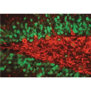 ChIPAb + RNA Polymerase II