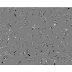 HSC-4 Cell:人口腔鱗癌細胞系