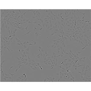 CaES-17細胞：人食管癌細胞系