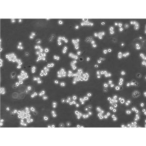 OCI-Ly19細胞：人彌漫大B淋巴瘤細胞系