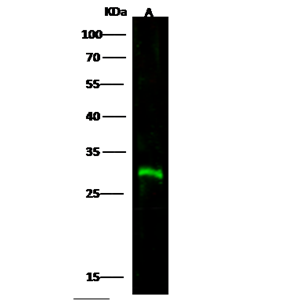 ANTI-CTLA4抗體