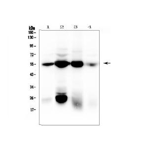 MOUSE ANTI HUMAN VIMENTIN 抗體