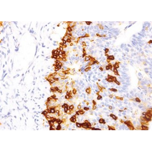 ANTI-NERVE GROWTH FACTOR RECEPTOR