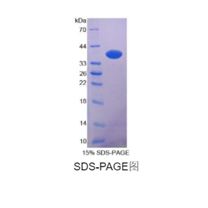 N-myc下游調(diào)節(jié)基因2(NDRG2)重組蛋白