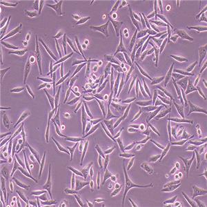 SMMC-7721-coGFP（人肝癌細(xì)胞-綠色熒光蛋白標(biāo)記（STR鑒定正確））