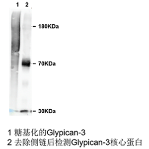 glypican 3小鼠單抗；Anti-Glypican 3 antibody; GPC3 