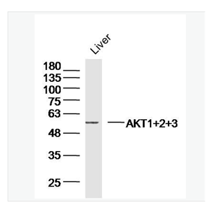 Anti-AKT1+2+3 antibody- 蛋白激酶AKT1,2,3抗體