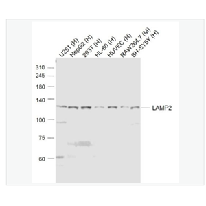 Anti-LAMP2 antibody -溶酶體相關(guān)膜蛋白2（CD107B）抗體