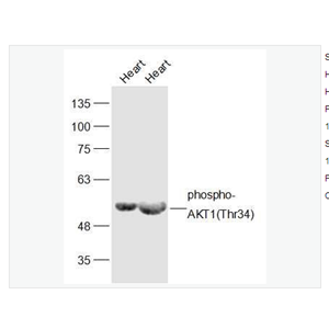 Anti-phospho-AKT1 antibody -磷酸化蛋白激酶B抗體