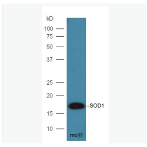 Anti-SOD1 antibody-超氧化物歧化酶1（銅/鋅過氧化物歧化酶SOD抗體)