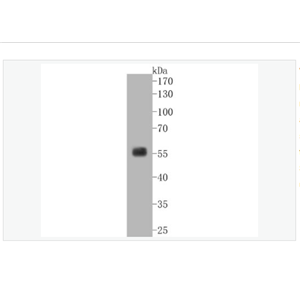 Anti-SGK1 antibody  -糖皮質(zhì)激素調(diào)節(jié)激酶1重組兔單克隆抗體