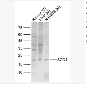 Anti-SOD1 antibody-超氧化物歧化酶1（銅/鋅過氧化物歧化酶SOD）抗體