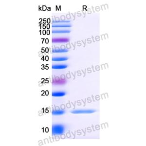 Anti-Vesicular stomatitis Indiana virus/VSIV NP/Nucleoprotein Nanobody (SAA1193)