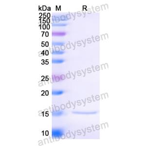 Anti-HIV1 Surface protein gp120 Nanobody (SAA0884)