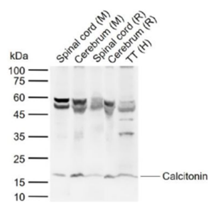 Anti-Calcitonin antibody-降鈣素抗體