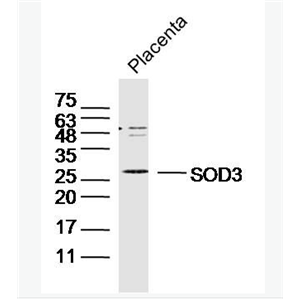 Anti-SOD3 antibody-超氧化物歧化酶3抗體