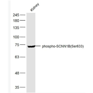 Anti-phospho-SCNN1B (Ser633) antibody-磷酸化上皮鈉通β抗體