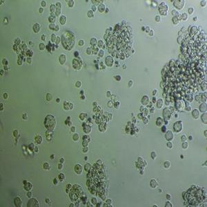 CaES-17人食管癌細胞