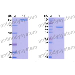 Research Grade Anti-RSV F/Fusion glycoprotein F0 (R1.42) (DVV02815)