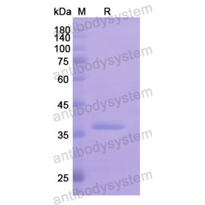 Recombinant Human P4HA2, N-His