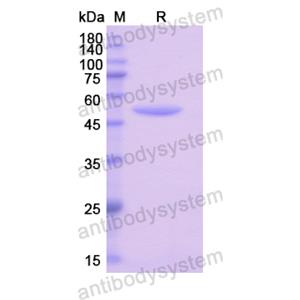 Recombinant Human RS1, N-GST