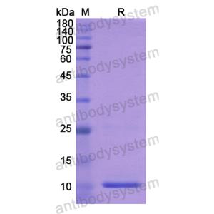 Recombinant Human PLXNB1, N-His