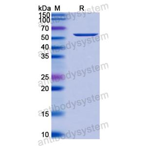 Recombinant TRSV 2C-CP/Coat protein, C-His