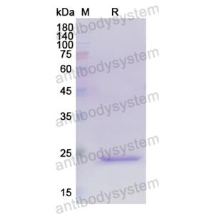 Recombinant Human TNFSF15, N-His