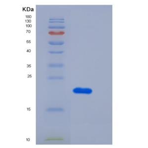 Recombinant Human TNFRSF1A Protein (His Tag)