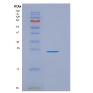 Recombinant Human FcERI / FCER1A Protein (His tag)