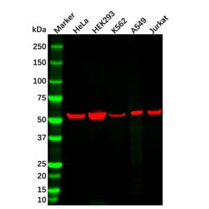 aladdin 阿拉丁 Ab179444 Vimentin Mouse mAb mAb (AB07/4H7); Mouse anti Vimentin Antibody; WB, Flow, ICC/IF, ELISA; Unconjugated