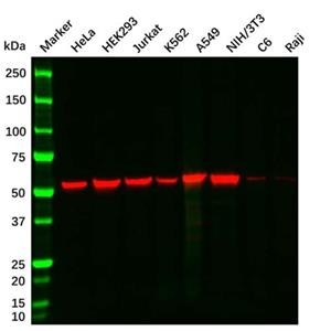 aladdin 阿拉丁 Ab179919 Vimentin Mouse mAb mAb (AB08/4A9); Mouse anti Vimentin Antibody; WB, Flow, ICC/IF, ELISA; Unconjugated