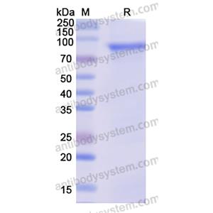 RecombiRecombinant Influenza A virus HA/Hemagglutinin Protein, N-Hisnant Influenza A virus HA/Hemagglutinin Protein, N-His