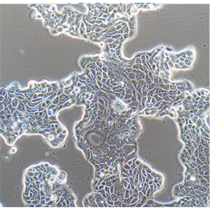 人喉鱗狀細(xì)胞癌SNU1076