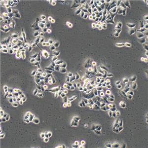 Li-7 Cells人肝癌復(fù)蘇細(xì)胞系(有STR鑒定圖譜)