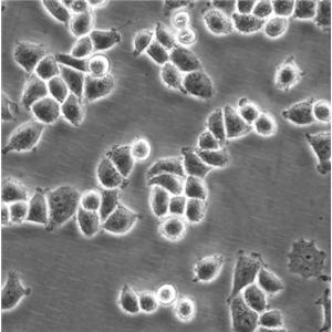 NCI-H1299 Cells人非小細胞肺癌復(fù)蘇細胞系(有STR鑒定圖譜)