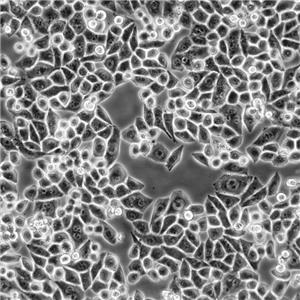 NCI-H292 Cells人肺癌復(fù)蘇細胞系<淋巴結(jié)轉(zhuǎn)移>(有STR鑒定圖譜)