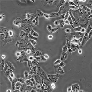 SW-1990 Cells#人胰腺癌細(xì)胞系低代次|培養(yǎng)基|贈STR圖譜